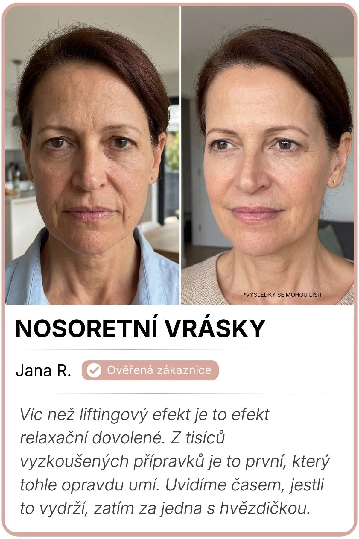 Vorher-Nachher-Bild von Jana R.
