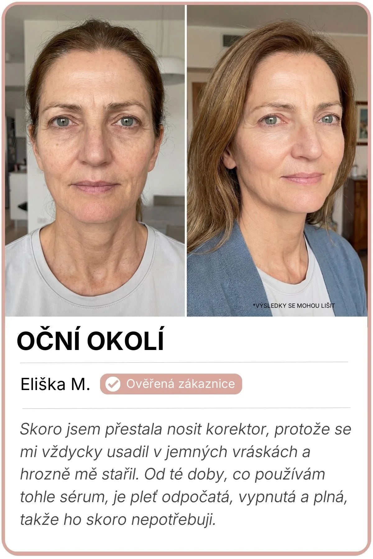 Vorher-Nachher-Bild von Eliška M.