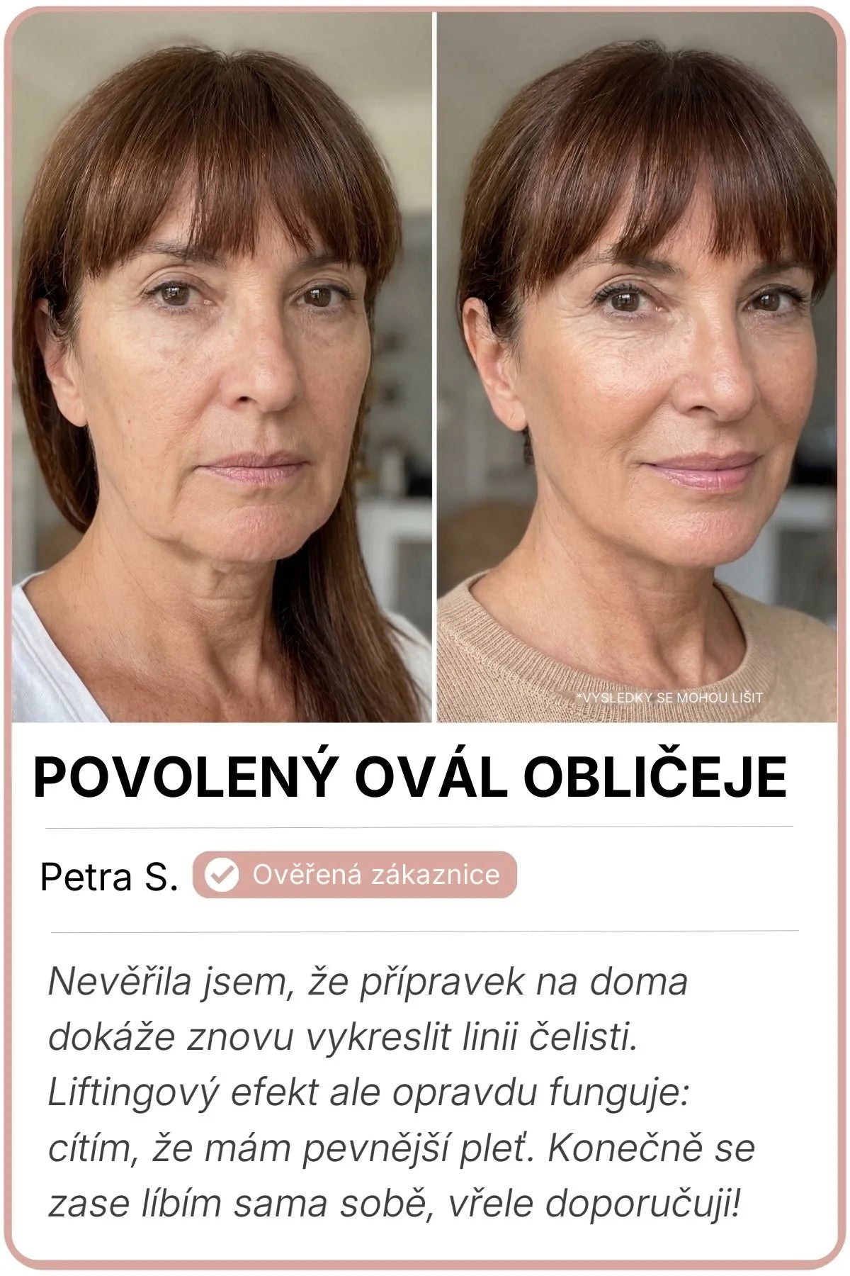 Vorher-Nachher-Bild von Petra S.