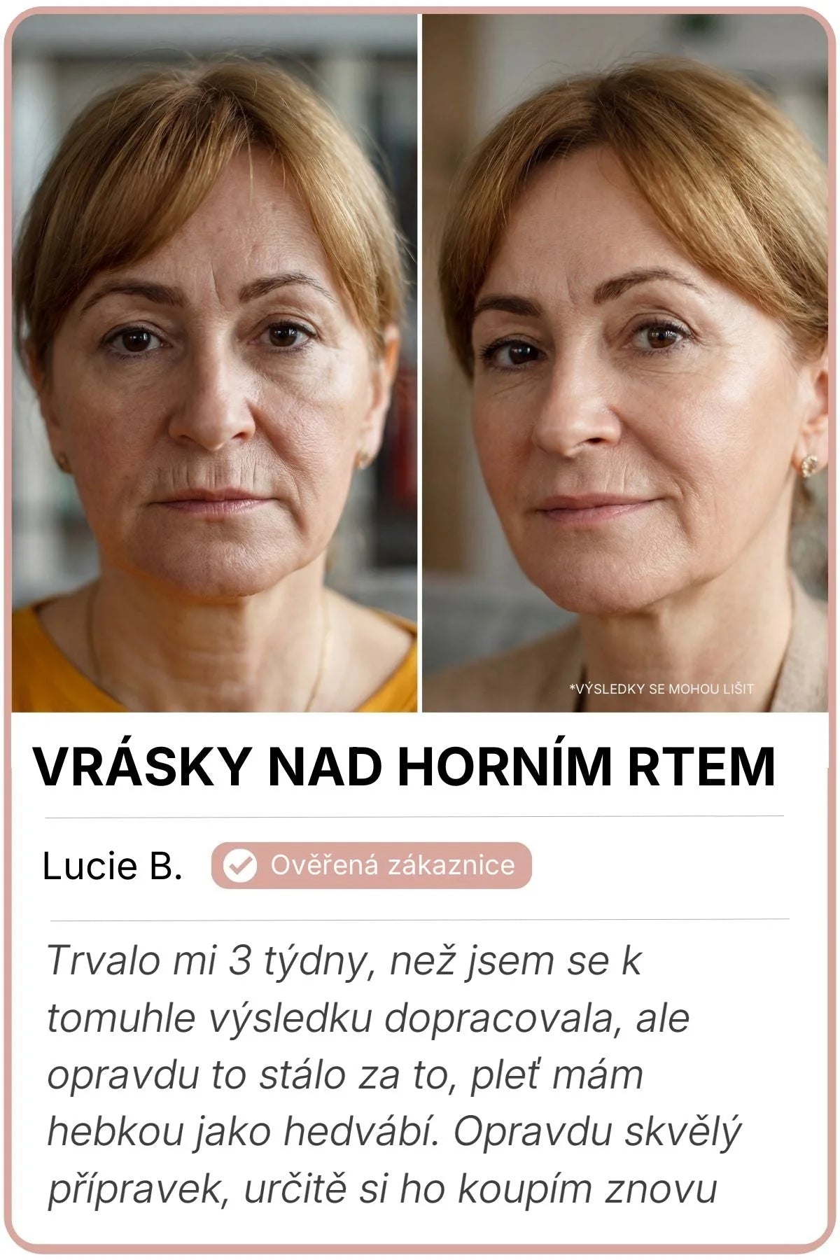 Vorher-Nachher-Bild von Lucie B.