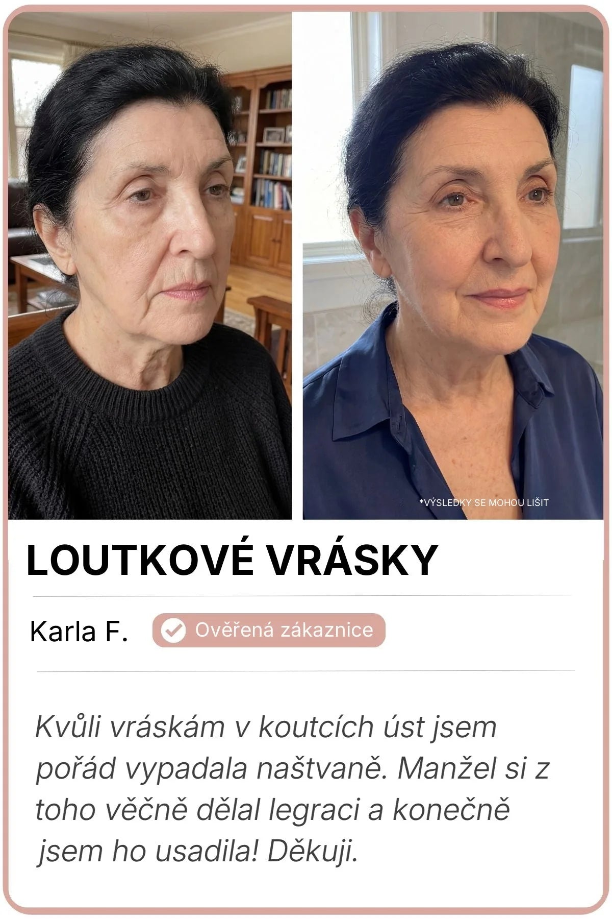 Vorher-Nachher-Bild von Karla F.